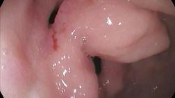 Двойной привратник.